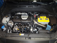 Thumbnail for Injen 18-20 Hyundai Kona L4-1.6L Turbo Laser Black IS Short Ram Cold Air Intake System